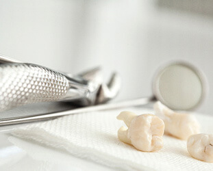 models of teeth on napkin next to dental mirror