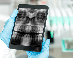 Tablet displaying panoramic dental x-rays