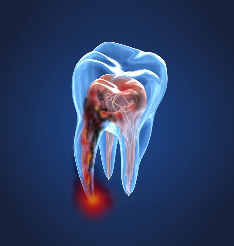 diagram of a tooth and its root